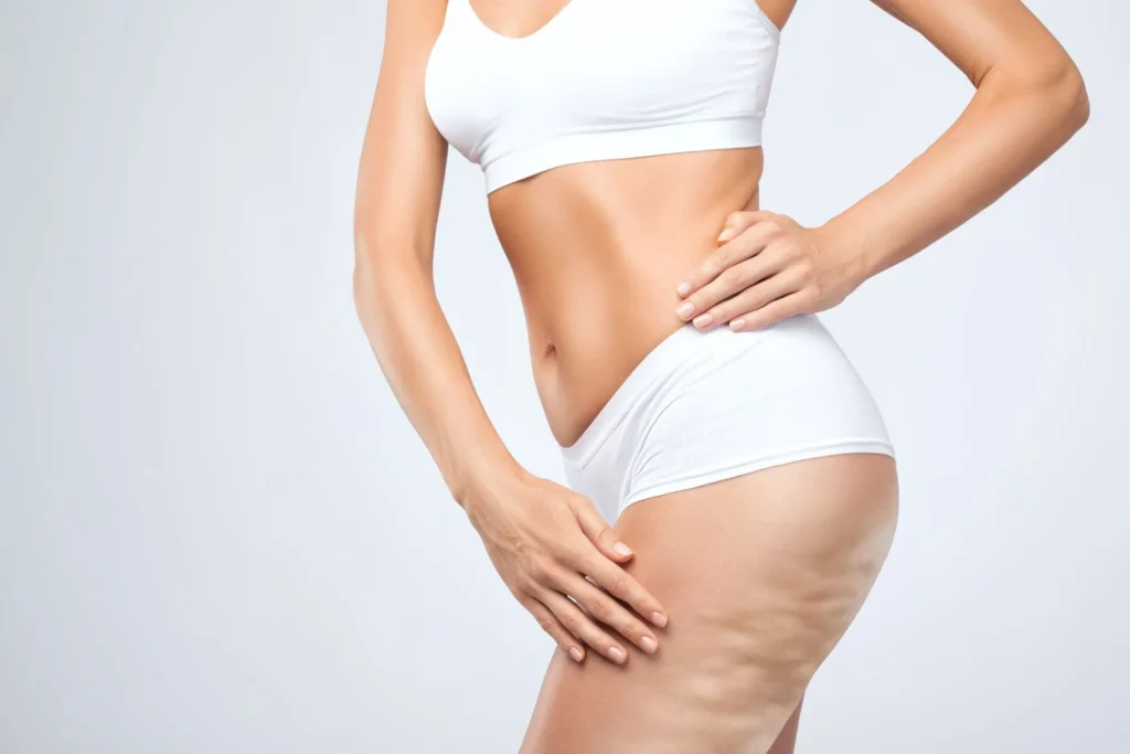 Avéli Cellulite Removal in Centennial, CO | Shape Aesthetics