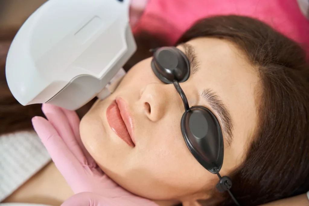 IPL Photo-Facial in Centennial, CO | Shape Aesthetics