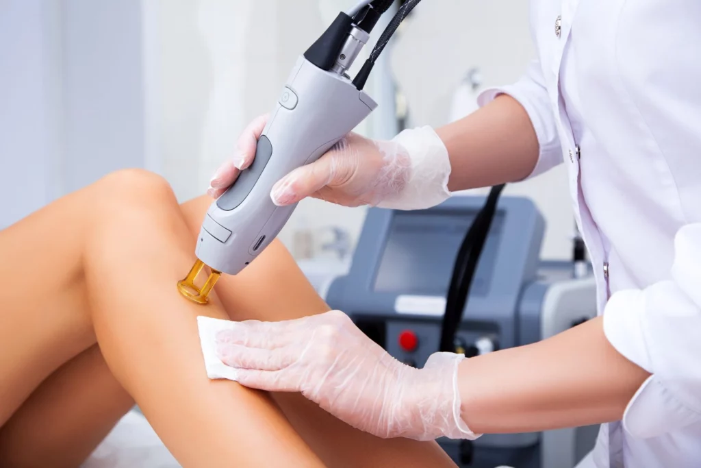 Laser Hair Removal in Centennial, CO | Shape Aesthetics